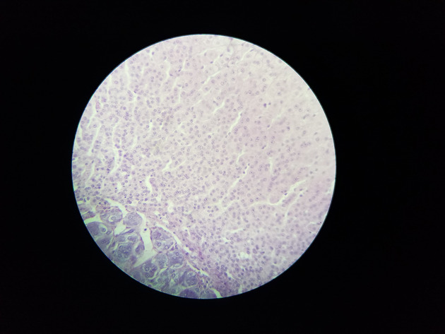 Adrenal Slides - Adrenal 009 100X
